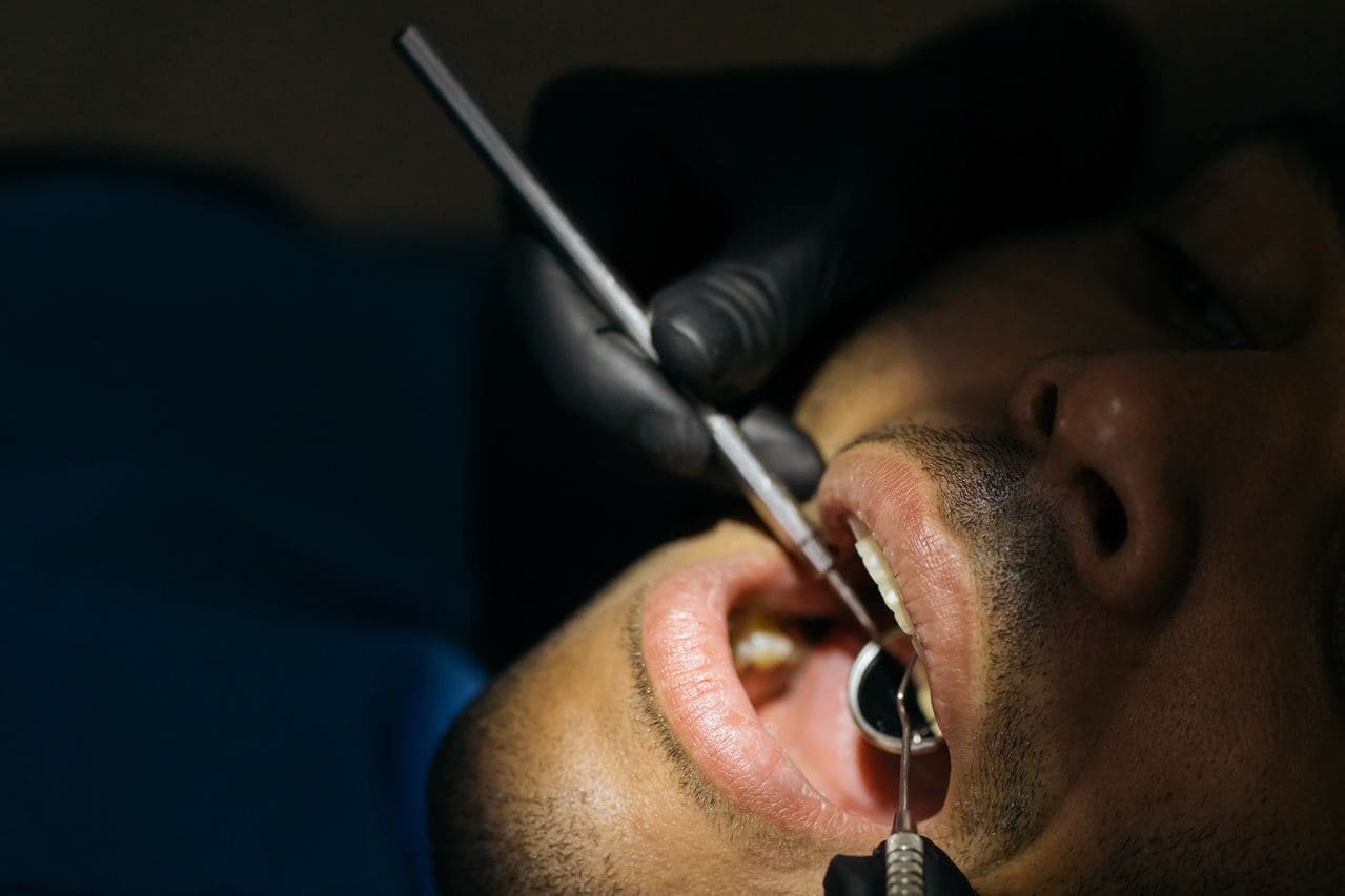 El curetaje en la tercera edad y su importancia para la salud dental